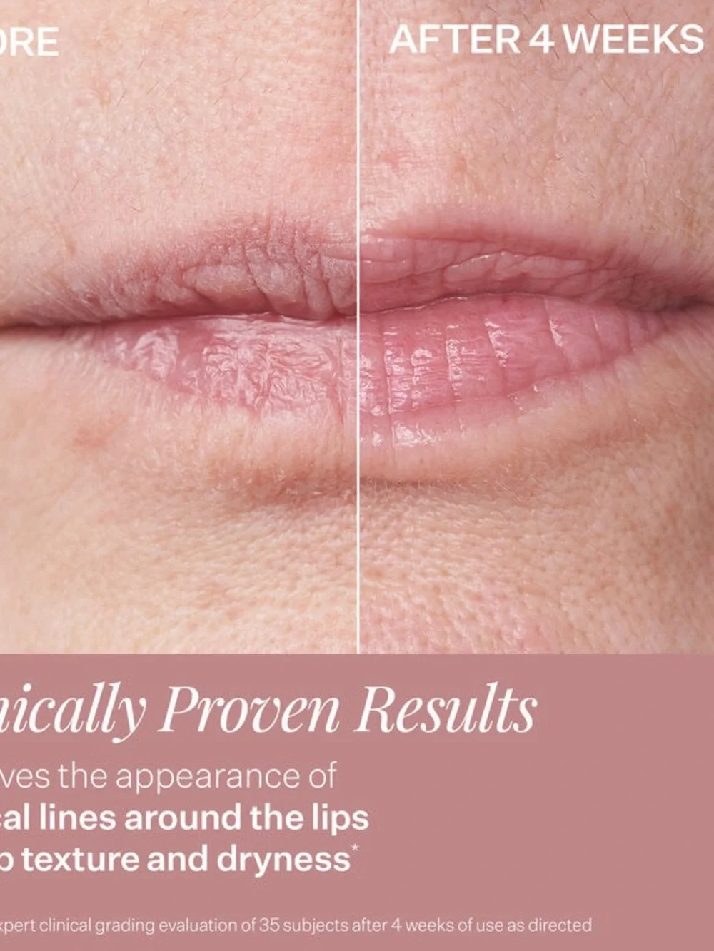 StriVectin Double-LX Plumping Lip Treatment - Deep Berry Pink
